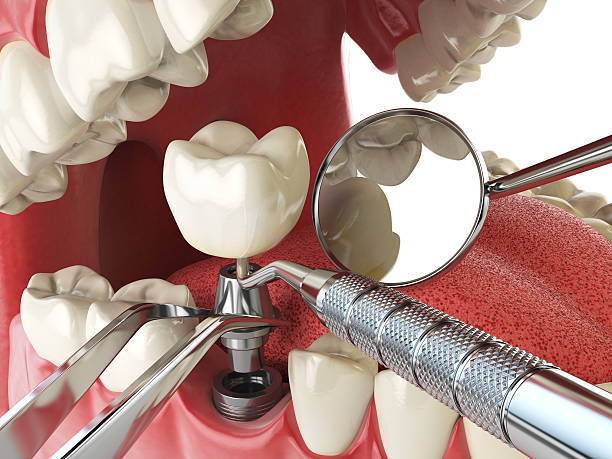 Best Emergency Treatment for Oral Infections in Brewster, NY